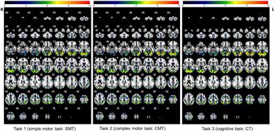 A neurophysiological approach to the distinction between motor and cognitive skills: a functional magnetic resonance imaging study